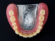 コバルトクロム金属床