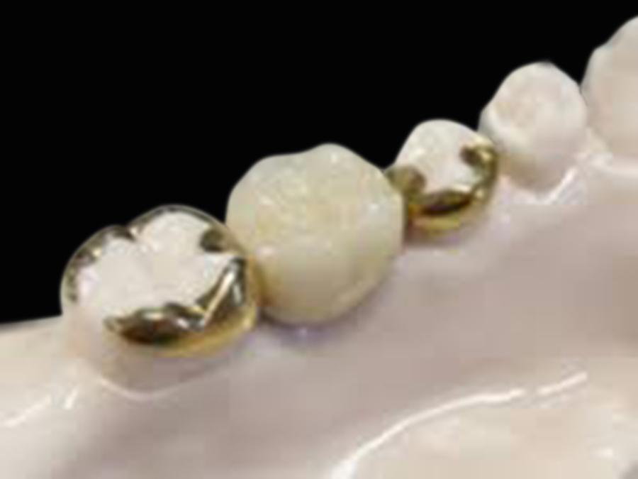 ヒューマンブリッジ