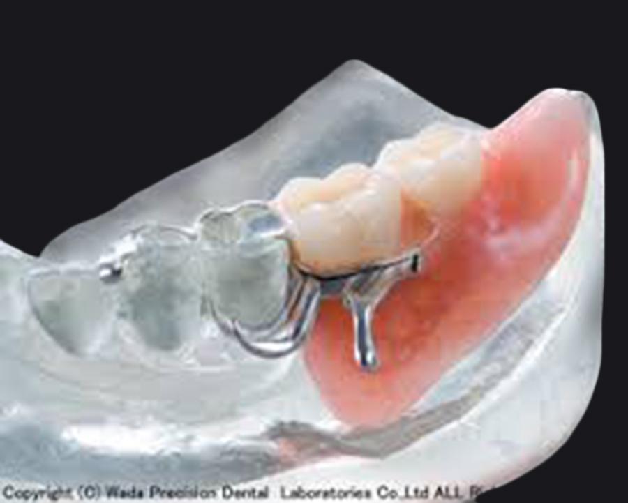 カムデンチャー