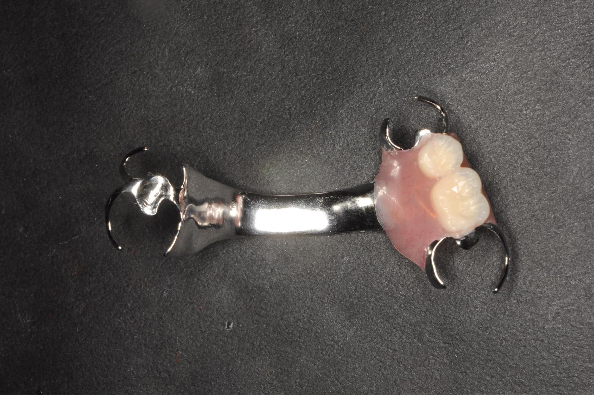 保険の部分入れ歯