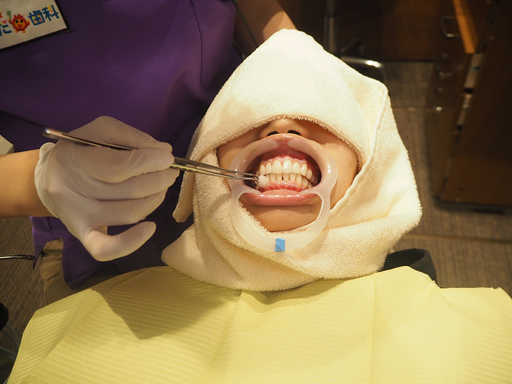 薬液を歯茎に塗ります