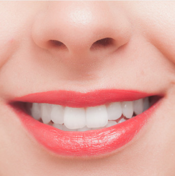 ホワイトニング