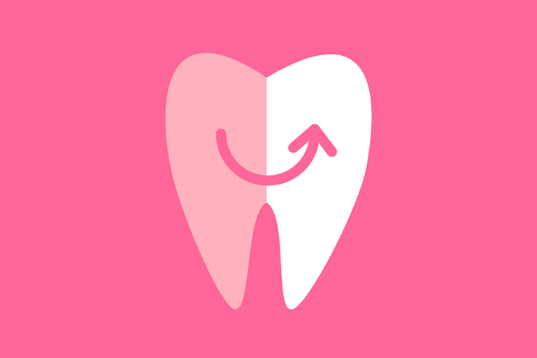 スペシャルホワイトニング